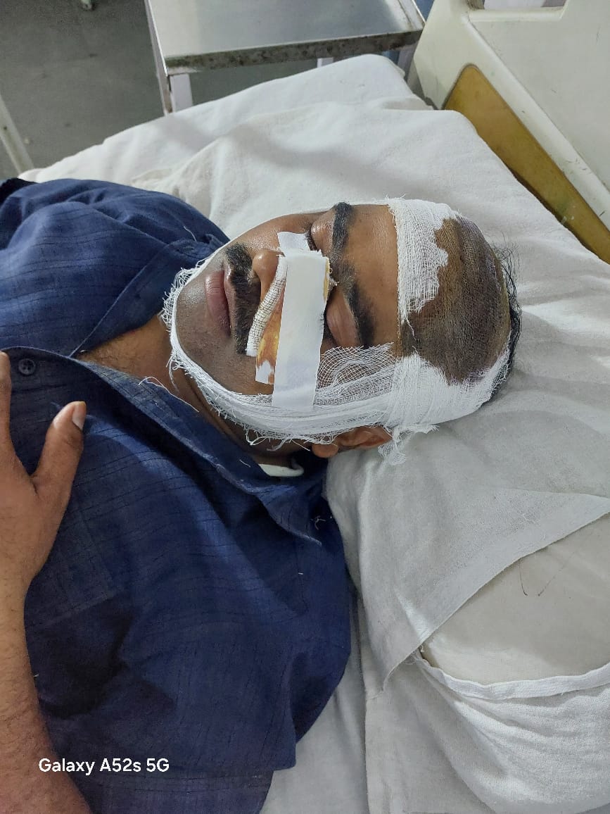 bareilly-dabang-attack-on-fertilizer-shop-captured-in-cctv